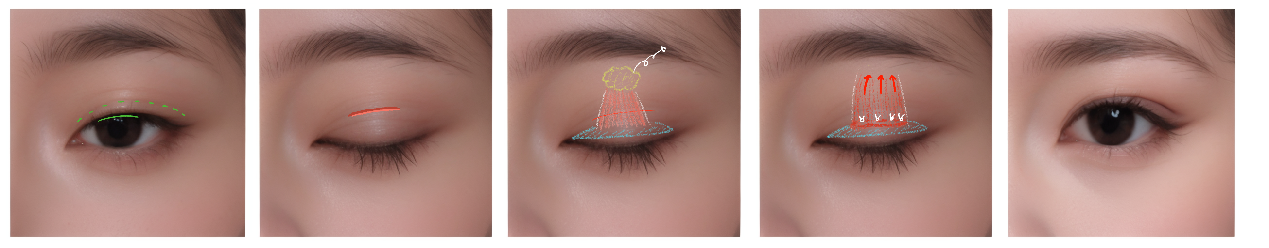 재건/종괴 치료 원리